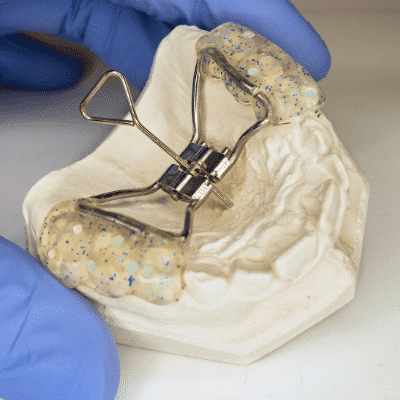 Palatal expander