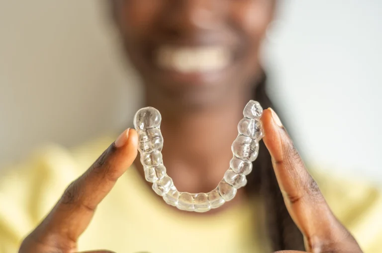 Spark Aligners